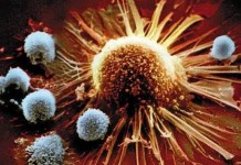 รับสมัครผู้ป่วยมะเร็งที่ไม่ประสงค์ใช้เคมีบำบัดและรังสีบำบัด เข้าร่วมโครงการดูแลสุขภาพด้วยวิธี”ภูมิคุ้มกันบำบัด”