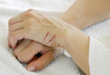 อุดรธานี เตือนผู้สัมผัสแมวที่มีเชื้อโรคพิษสุนัขบ้า พื้นที่อำเภอหนองหาน รีบพบแพทย์ด่วน