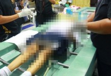 เด็กหญิง10ขวบเป็นลมล้มขาดใจหน้าเสาธง