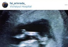 หนุ่ม อรรถพร” ประกาศข่าวดีภรรยา “ฝ้าย อริญรดา” ตั้งท้องลูกคนที่ 2