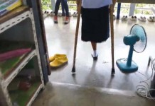 สะเทือนใจ ! เด็กหญิงวัย 13 ถูกรถชนจนต้องตัดขา